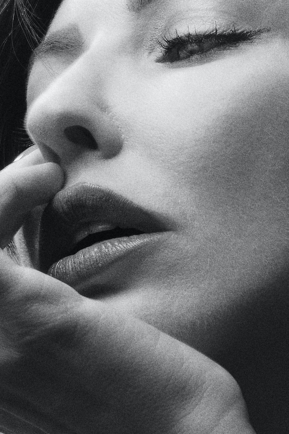 Dermal Fillers