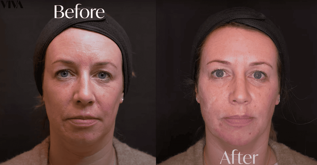 BA Cheeks 1024x534 BA Cheeks 1024x534