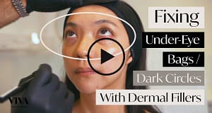 614cb7df733b7 fbutube Teartroughfiller 300x160 614cb7df733b7 fbutube Teartroughfiller 300x160