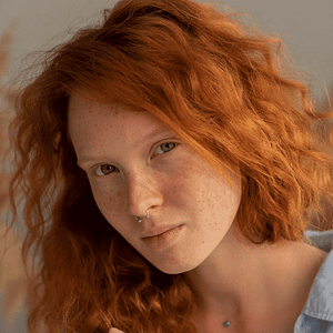 All Conditions 22 Condition-Facial-Volume-Loss-at-Viva