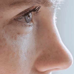 All Conditions 19 Condition-Misshapen-Nose-at-Viva