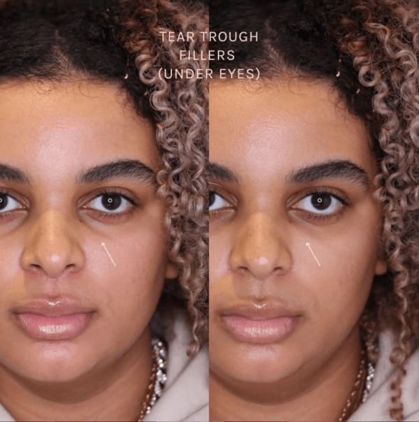 Cheat sleep: the best treatments for looking more awake