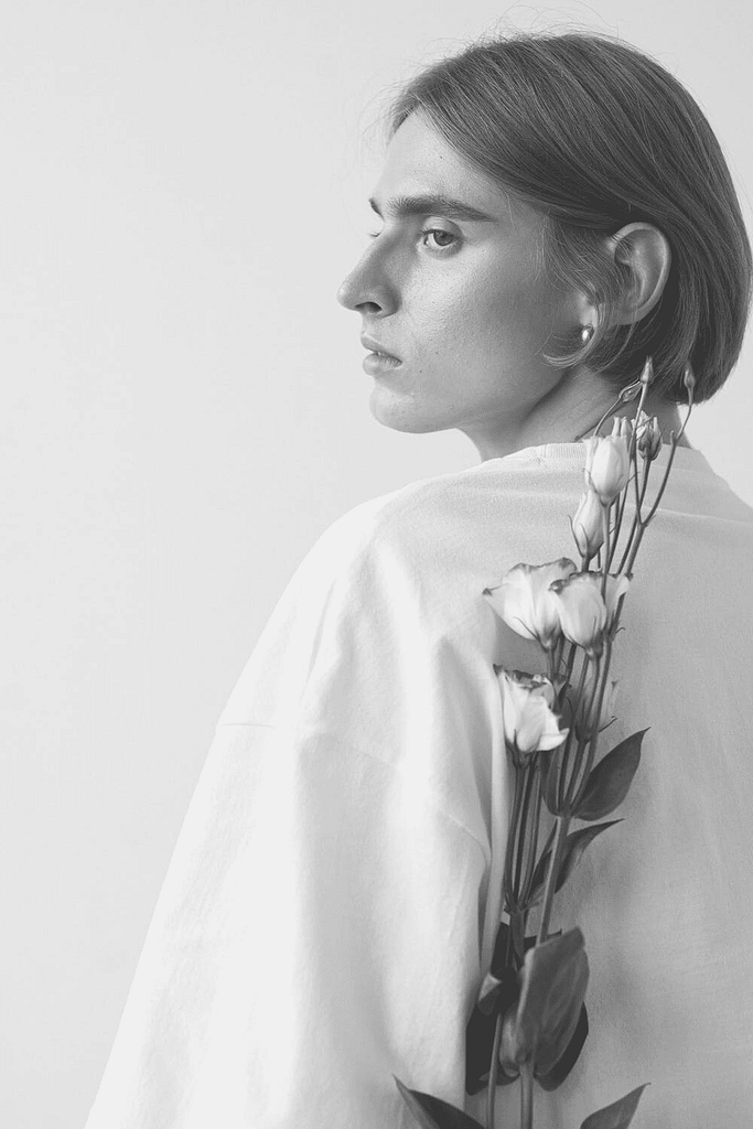 cheek fillers, cheek fillers before and after