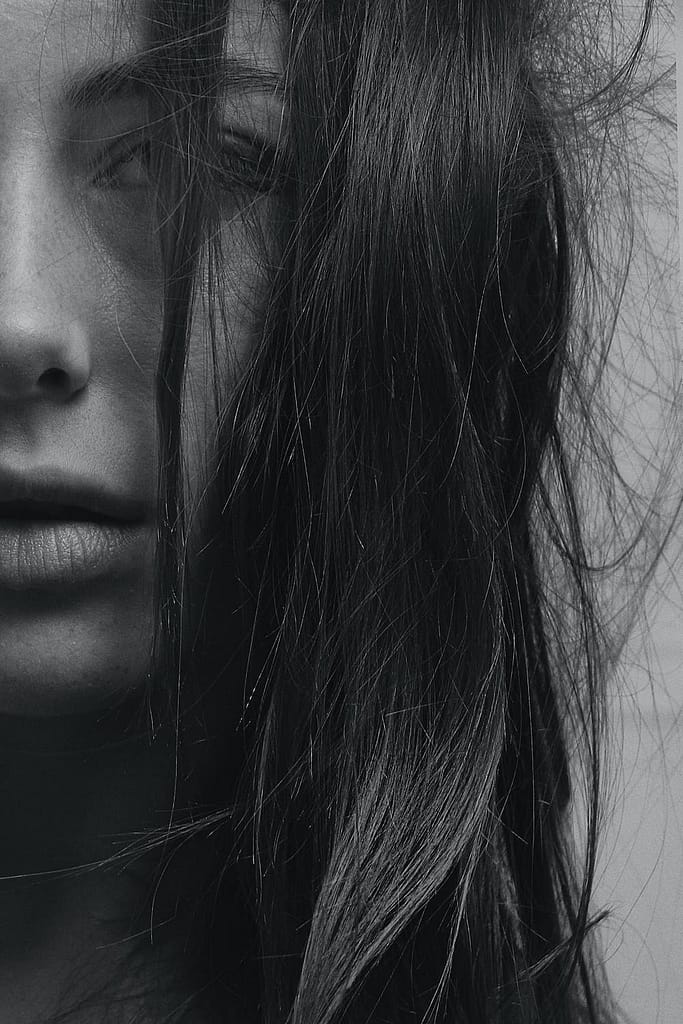 lip filler swelling, how long does lip filler swelling last, lip filler swelling stages