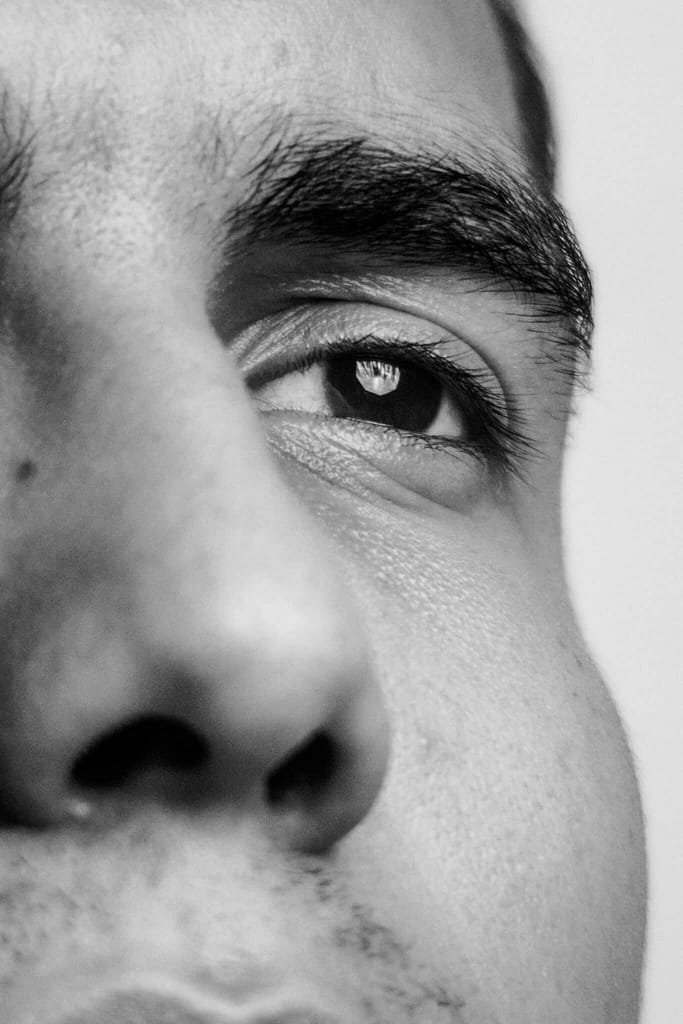 mens cheek filler, mens cheekbone filler