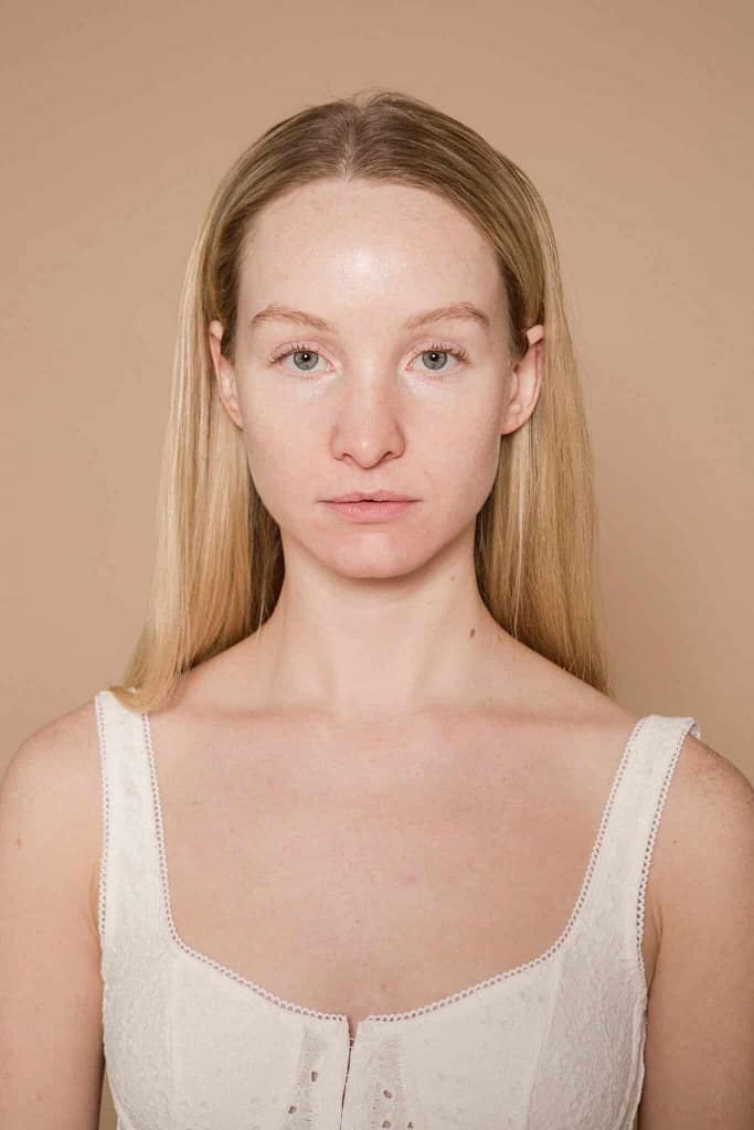 All Treatments 3 Chemical Peels at Viva