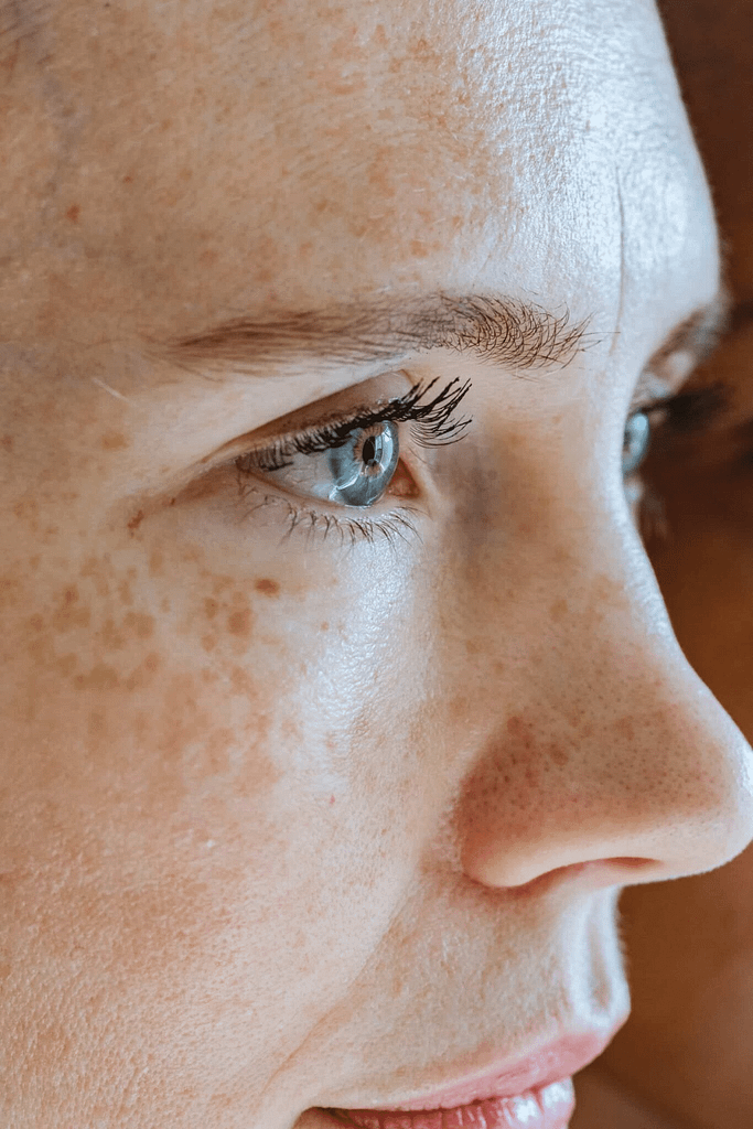 All Treatments 23 Treatment-Non-Surgical-Rhinoplasty-at-Viva