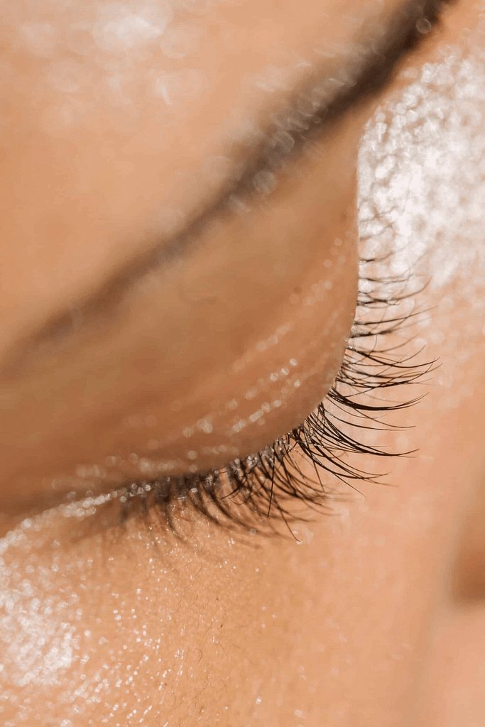 Treatment-tear-trough-filler-at-viva