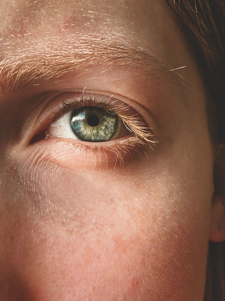 how to get rid of dark cirlces