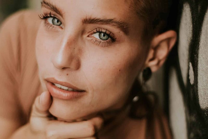 Dermal fillers gone wrong: fixing filler complications 1 women smiling face