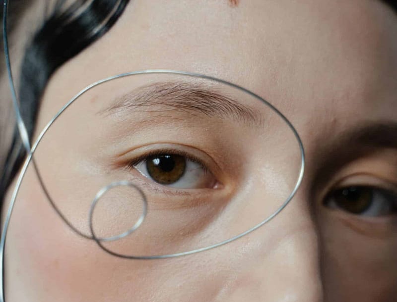 Tear trough dermal fillers