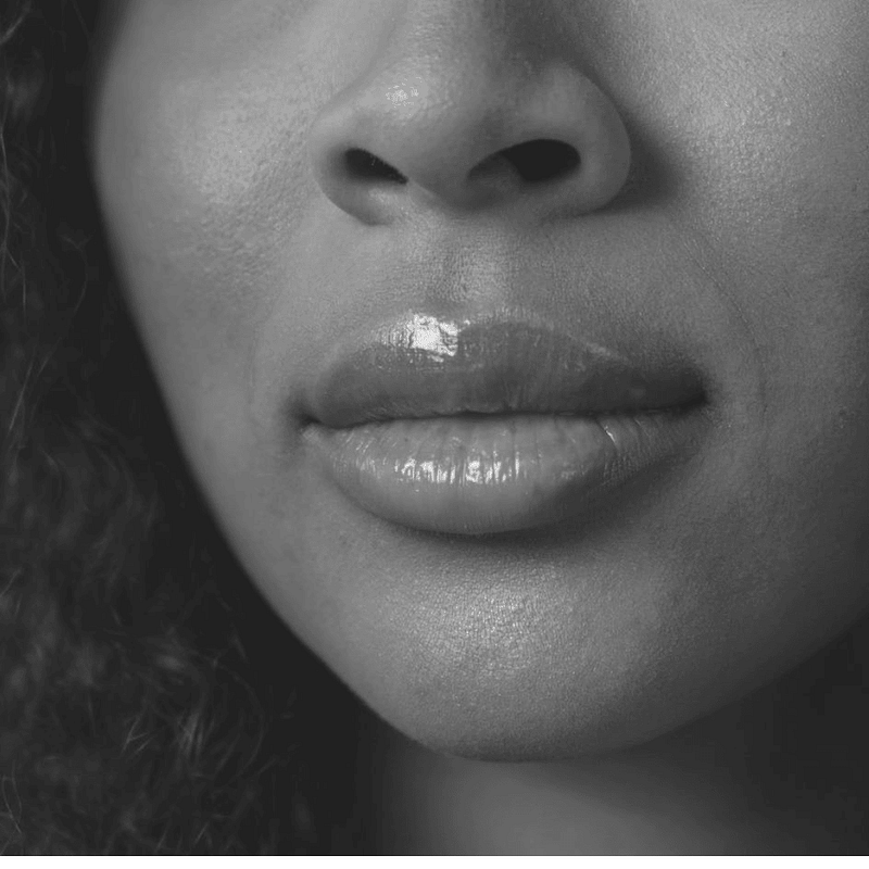 what do to after lip filler