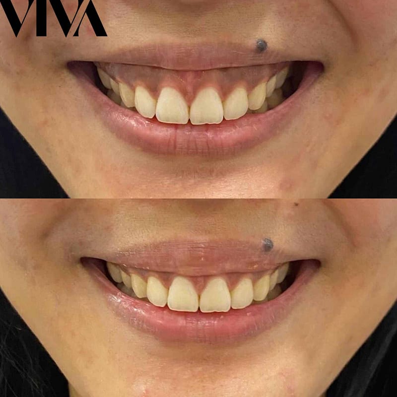 Before & Afters 14 lucy before and after 2 scaled 1